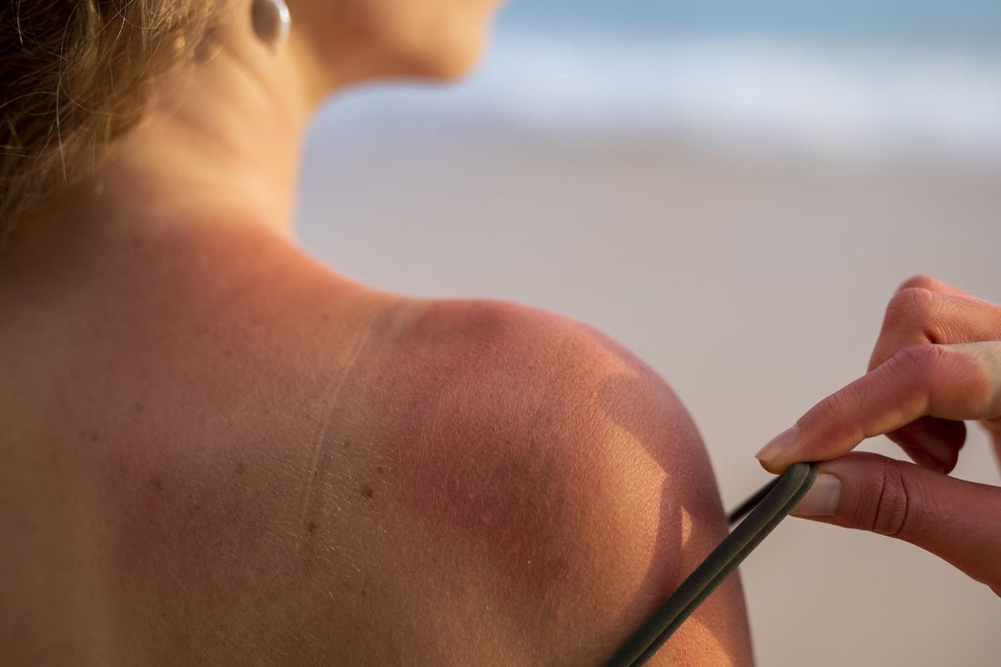 How Does Sun Exposure Lead to Skin Aging, and What Are the Best Ways to Prevent UV Damage?