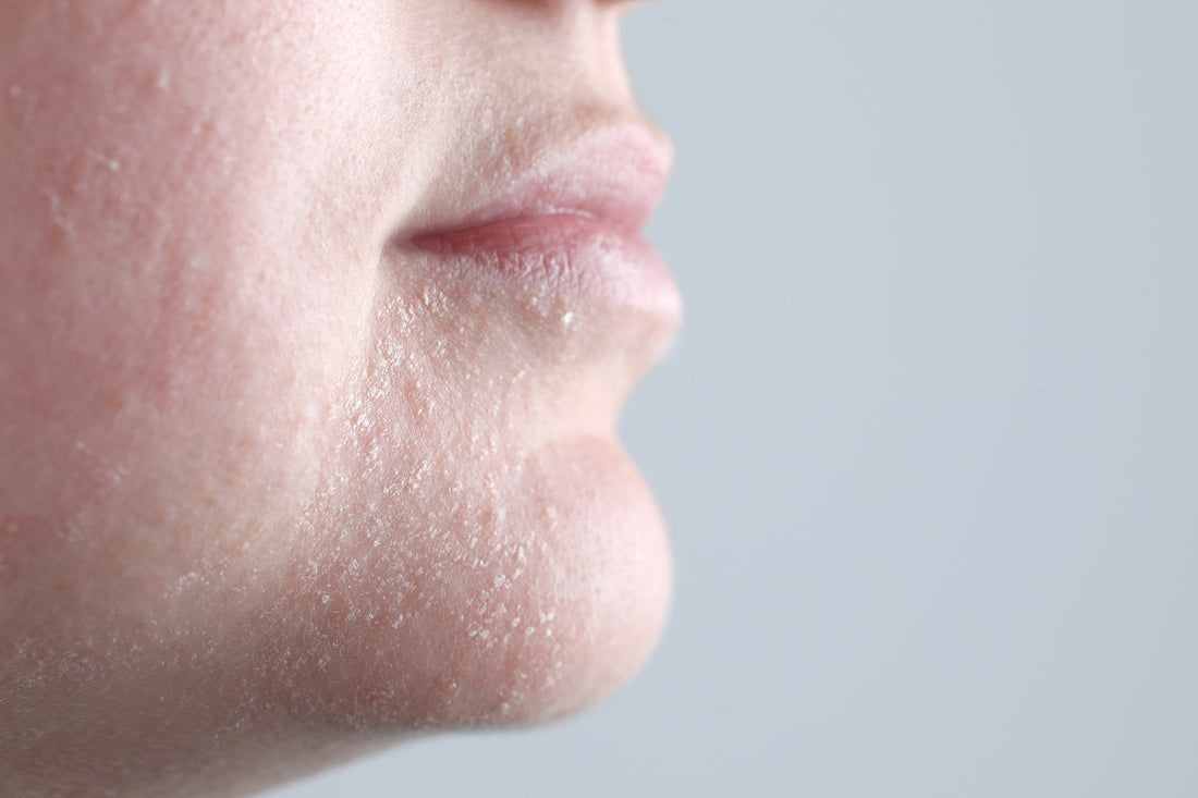 How Do Weather Conditions and Climate Change Affect Your Skin?