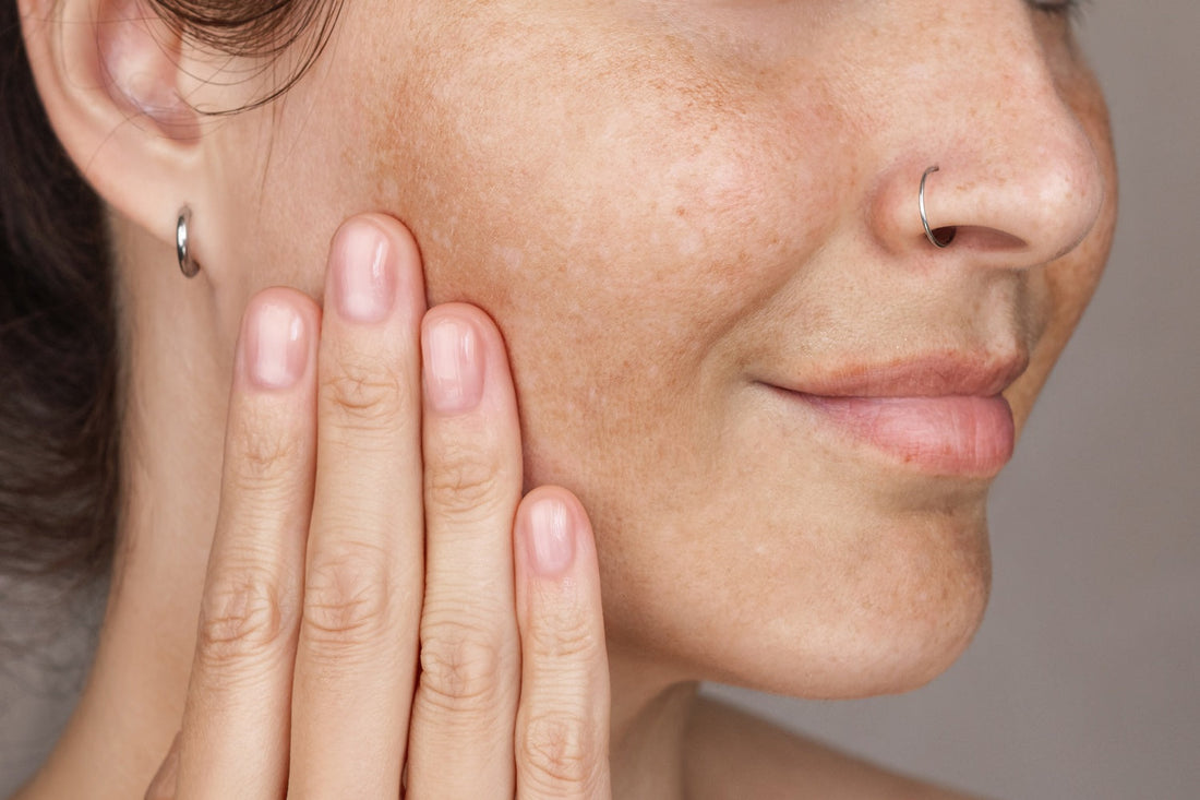 How Does Sea Moss Help to Even Skin Tone and Reduce the Appearance of Dark Spots and Hyperpigmentation?